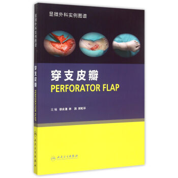 穿支皮瓣 穿支皮瓣