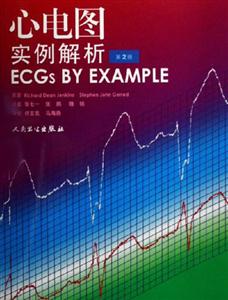 心電圖實例解析 心電圖實例解析