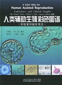 人類輔助生殖彩色圖譜 人類輔助生殖彩色圖譜